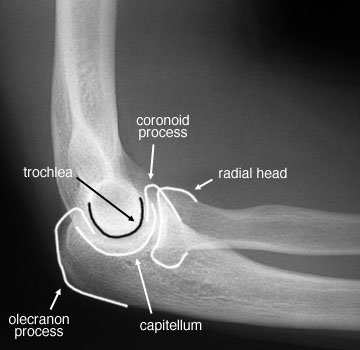 Radiographic Anatomy of the Skeleton: Elbow -- Lateral View, Labelled