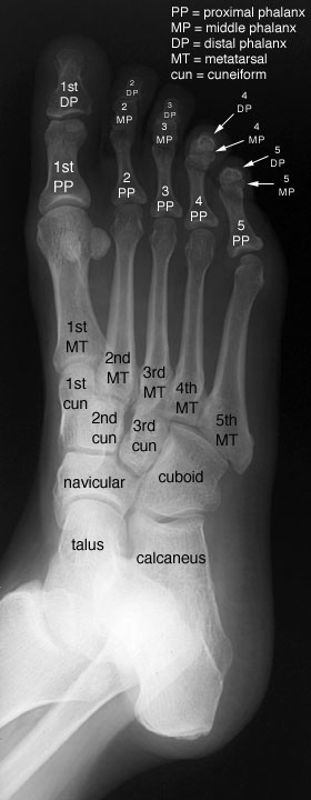Radiographic Anatomy of the Skeleton: Foot -- Oblique View, Labelled