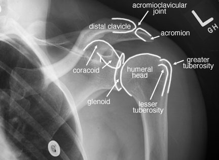 Radiographic Anatomy of the Skeleton: Shoulder -- External Rotation