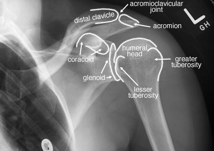 Radiographic Anatomy of the Skeleton: Shoulder -- Internal Rotation