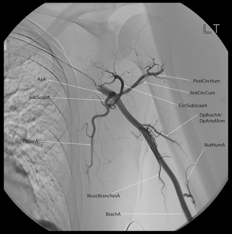 Labeled Angiograms