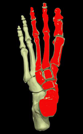 medial column