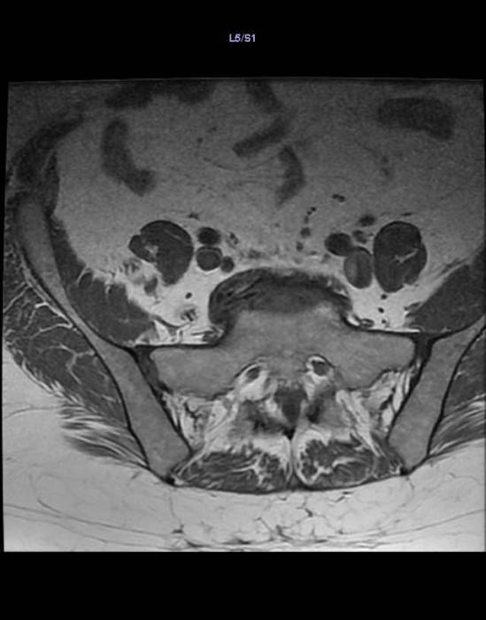 picture11.jpg picture11.jpg