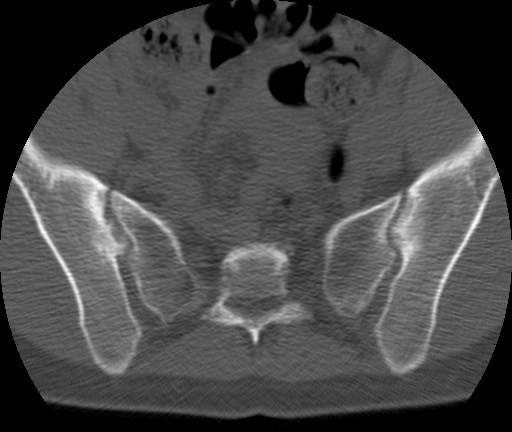 Sternomanubrial Joint