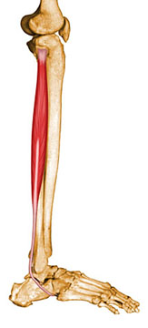 Peroneus Longus Muscle: <STRONG><U>Peroneus Longus Muscle</U></STRONG>