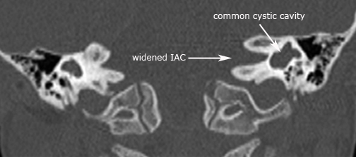 label.Cor.common_cavity.jpg