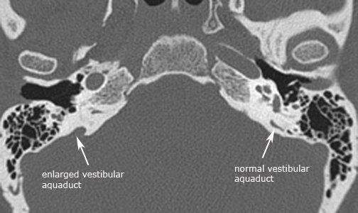 label.axial_VA_1.jpg